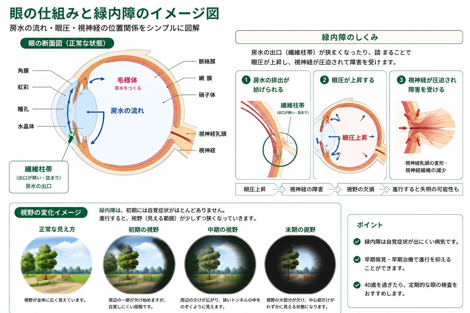 緑内障の仕組み：眼の構造と房水の流れ