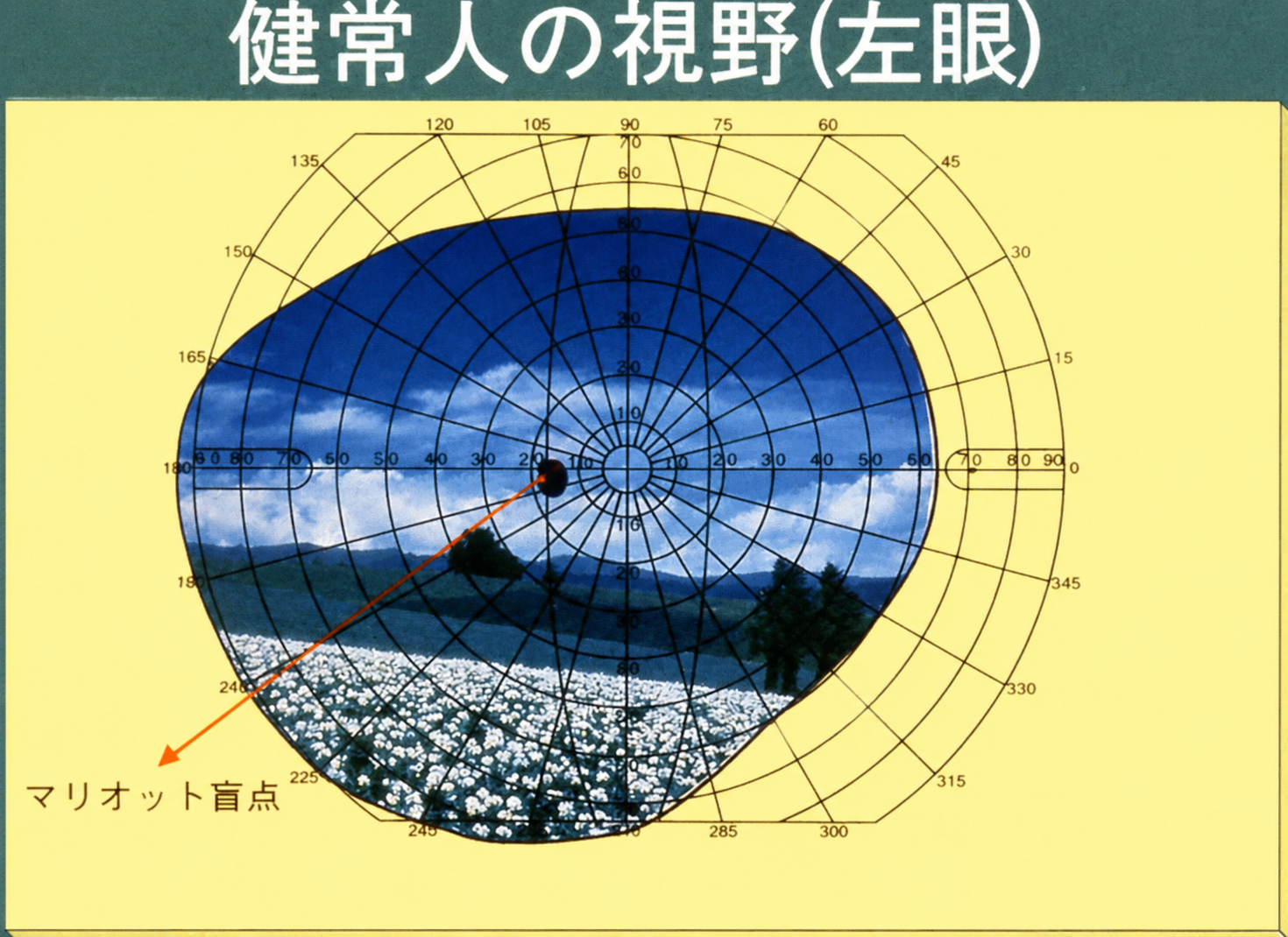 正常な視野